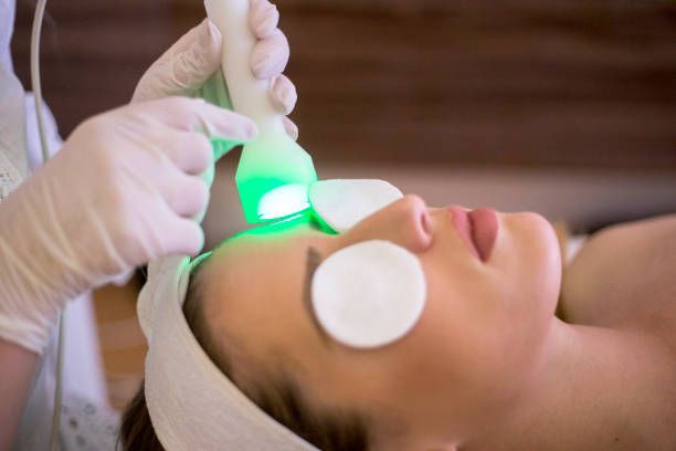 How Do Microneedling Treatment Services Improve Skin Elasticity?
